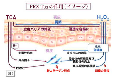 PRX-T33使用イメージ